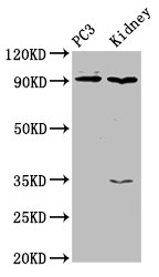 CDK11A / CDC2L2 Antibody - Western Blot Positive WB detected in: PC-3 whole cell lysate, Rat kidney tissue All lanes: CDK11A antibody at 4µg/ml Secondary Goat polyclonal to rabbit IgG at 1/50000 dilution Predicted band size: 92, 91, 46, 19, 63, 50 kDa Observed band size: 92 kDa