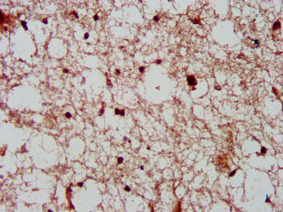 CDK11A / CDC2L2 Antibody - IHC image of CDK11A Antibody diluted at 1:600 and staining in paraffin-embedded human brain tissue performed on a Leica BondTM system. After dewaxing and hydration, antigen retrieval was mediated by high pressure in a citrate buffer (pH 6.0). Section was blocked with 10% normal goat serum 30min at RT. Then primary antibody (1% BSA) was incubated at 4°C overnight. The primary is detected by a biotinylated secondary antibody and visualized using an HRP conjugated SP system.