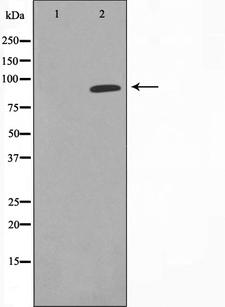 CDK11A / CDC2L2 Antibody - Western blot analysis on COLO cell lysates using CDK11 antibody. The lane on the left is treated with the antigen-specific peptide.