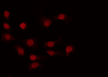 CDK11A / CDC2L2 Antibody - Staining COLO cells by IF/ICC. The samples were fixed with PFA and permeabilized in 0.1% Triton X-100, then blocked in 10% serum for 45 min at 25°C. The primary antibody was diluted at 1:200 and incubated with the sample for 1 hour at 37°C. An Alexa Fluor 594 conjugated goat anti-rabbit IgG (H+L) Ab, diluted at 1/600, was used as the secondary antibody.