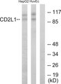CDK11B / CDC2L1 Antibody - Western blot analysis of lysates from HUVEC and HepG2 cells, using CDC2L1 Antibody. The lane on the right is blocked with the synthesized peptide.