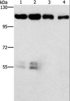 CDK11B / CDC2L1 Antibody - Western blot analysis of HeLa and hepG2 cell, LOVO cell and human colon cancer tissue, using CDK11A/CDK11B Polyclonal Antibody at dilution of 1:750.