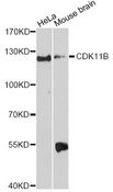 CDK11B / CDC2L1 Antibody - Western blot analysis of extracts of various cell lines, using CDK11B Antibody at 1:3000 dilution. The secondary antibody used was an HRP Goat Anti-Rabbit IgG (H+L) at 1:10000 dilution. Lysates were loaded 25ug per lane and 3% nonfat dry milk in TBST was used for blocking. An ECL Kit was used for detection and the exposure time was 90s.