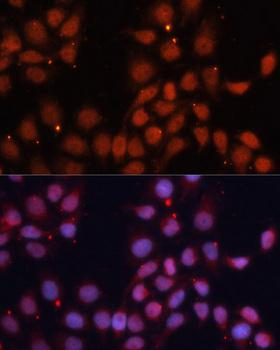 CDK11B / CDC2L1 Antibody - Immunofluorescence analysis of HeLa cells using CDK11B Polyclonal Antibody at dilution of 1:100.Blue: DAPI for nuclear staining.