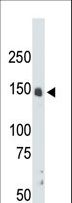 CDK12 / CRKRS Antibody - The anti-CRK7 antibody is used in Western blot to detect CRK7 in mouse liver tissue lysate.