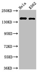 CDK12 / CRKRS Antibody - Positive Western Blot detected in Hela whole cell lysate, K562 whole cell lysate. All lanes: CDK12 antibody at 2 µg/ml Secondary Goat polyclonal to rabbit IgG at 1/50000 dilution. Predicted band size: 165, 164, 142 KDa. Observed band size: 165 KDa