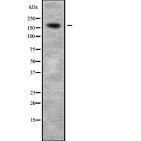 CDK12 / CRKRS Antibody - Western blot analysis of CD2L7 using HuvEc whole cells lysates