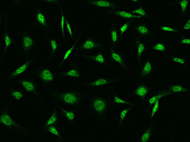 CDK13 / CDC2L5 Antibody - Immunofluorescence staining of CDK13 in HeLa cells. Cells were fixed with 4% PFA, permeabilzed with 0.1% Triton X-100 in PBS, blocked with 10% serum, and incubated with rabbit anti-Human CDK13 polyclonal antibody (dilution ratio 1:200) at 4°C overnight. Then cells were stained with the Alexa Fluor 488-conjugated Goat Anti-rabbit IgG secondary antibody (green). Positive staining was localized to Nucleus.