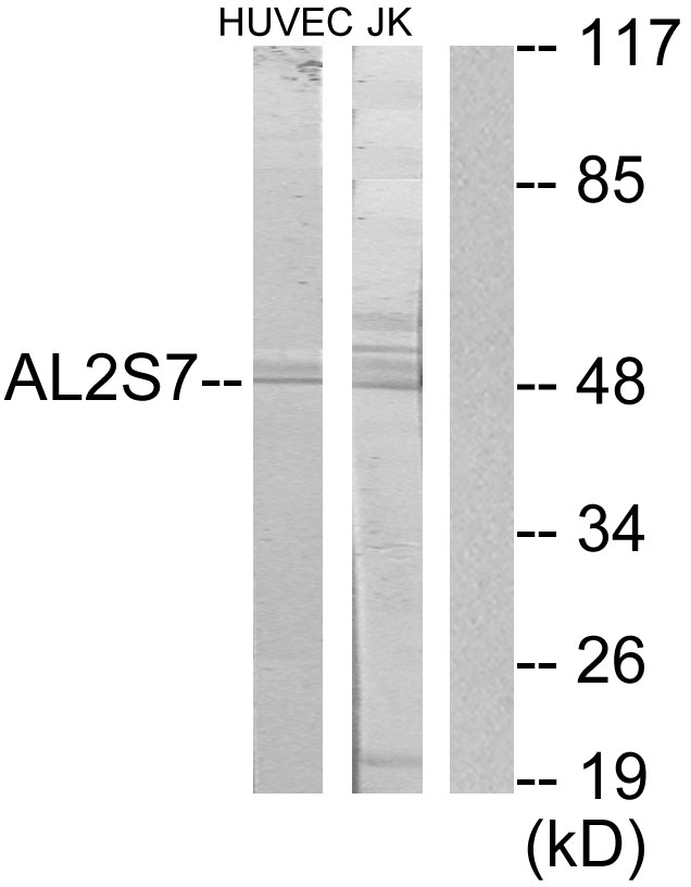 CDK15 / ALS2CR7 Antibody - Western blot analysis of lysates from Jurkat and HUVEC cells, using AL2S7 Antibody. The lane on the right is blocked with the synthesized peptide.