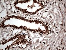 CDK15 / ALS2CR7 Antibody - Immunohistochemical staining of paraffin-embedded Human prostate tissue within the normal limits using anti-CDK15 mouse monoclonal antibody. (Heat-induced epitope retrieval by 1mM EDTA in 10mM Tris buffer. (pH8.5) at 120°C for 3 min. (1:500)