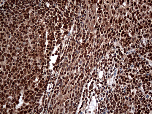 CDK15 / ALS2CR7 Antibody - Immunohistochemical staining of paraffin-embedded Human tonsil within the normal limits using anti-CDK15 mouse monoclonal antibody. (Heat-induced epitope retrieval by 1mM EDTA in 10mM Tris buffer. (pH8.5) at 120°C for 3 min(1:500)