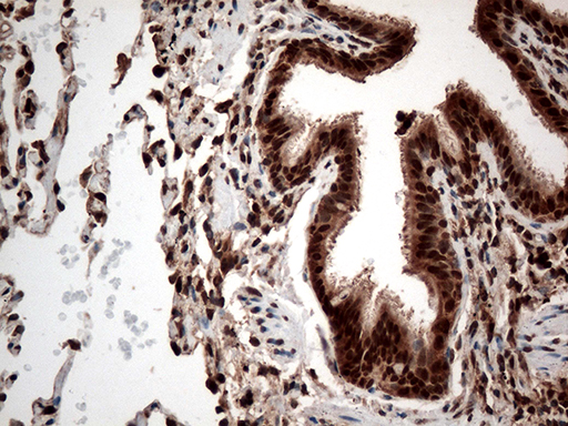 CDK15 / ALS2CR7 Antibody - Immunohistochemical staining of paraffin-embedded Human lung tissue within the normal limits using anti-CDK15 mouse monoclonal antibody. (Heat-induced epitope retrieval by 1mM EDTA in 10mM Tris buffer. (pH8.5) at 120°C for 3 min. (1:500)