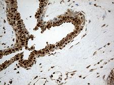 CDK15 / ALS2CR7 Antibody - Immunohistochemical staining of paraffin-embedded Human breast tissue within the normal limits using anti-CDK15 mouse monoclonal antibody. (Heat-induced epitope retrieval by 1mM EDTA in 10mM Tris buffer. (pH8.5) at 120°C for 3 min. (1:500)