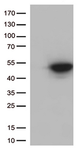 CDK15 / ALS2CR7 Antibody - HEK293T cells were transfected with the pCMV6-ENTRY control. (Left lane) or pCMV6-ENTRY CDK15. (Right lane) cDNA for 48 hrs and lysed. Equivalent amounts of cell lysates. (5 ug per lane) were separated by SDS-PAGE and immunoblotted with anti-CDK15. (1:500)