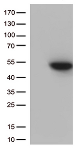 CDK15 / ALS2CR7 Antibody - HEK293T cells were transfected with the pCMV6-ENTRY control. (Left lane) or pCMV6-ENTRY CDK15. (Right lane) cDNA for 48 hrs and lysed. Equivalent amounts of cell lysates. (5 ug per lane) were separated by SDS-PAGE and immunoblotted with anti-CDK15. (1:500)