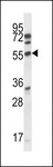 CDK15 / ALS2CR7 Antibody - ALS2CR7 Antibody (R13) western blot of A2058 cell line lysates (35 ug/lane). The ALS2CR7 antibody detected the ALS2CR7 protein (arrow).