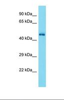 CDK15 / ALS2CR7 Antibody - Western blot of Mouse Brain. Cdk15 antibody dilution 1.0 ug/ml.  This image was taken for the unconjugated form of this product. Other forms have not been tested.