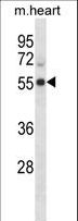 CDK15 / ALS2CR7 Antibody - Mouse Cdk15 Antibody western blot of mouse heart tissue lysates (35 ug/lane). The Cdk15 antibody detected the Cdk15 protein (arrow).