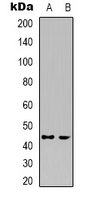 CDK15 / ALS2CR7 Antibody - Western blot analysis of CDK15 expression in HepG2 (A); Jurkat (B) whole cell lysates.