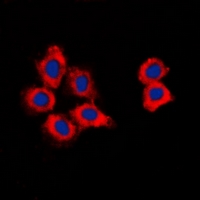 CDK15 / ALS2CR7 Antibody - Immunofluorescent analysis of CDK15 staining in HepG2 cells. Formalin-fixed cells were permeabilized with 0.1% Triton X-100 in TBS for 5-10 minutes and blocked with 3% BSA-PBS for 30 minutes at room temperature. Cells were probed with the primary antibody in 3% BSA-PBS and incubated overnight at 4 deg C in a humidified chamber. Cells were washed with PBST and incubated with a DyLight 594-conjugated secondary antibody (red) in PBS at room temperature in the dark. DAPI was used to stain the cell nuclei (blue).