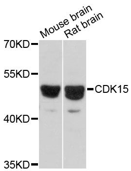 CDK15 / ALS2CR7 Antibody - Western blot analysis of extracts of various cell lines, using CDK15 antibody at 1:3000 dilution. The secondary antibody used was an HRP Goat Anti-Rabbit IgG (H+L) at 1:10000 dilution. Lysates were loaded 25ug per lane and 3% nonfat dry milk in TBST was used for blocking. An ECL Kit was used for detection and the exposure time was 30s.