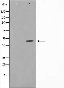 CDK15 / ALS2CR7 Antibody - Western blot analysis on Jurkat cell lysates using AL2S7 antibody. The lane on the left is treated with the antigen-specific peptide.