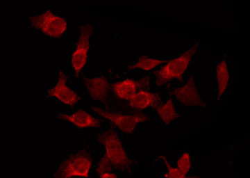 CDK15 / ALS2CR7 Antibody - Staining HepG2 cells by IF/ICC. The samples were fixed with PFA and permeabilized in 0.1% Triton X-100, then blocked in 10% serum for 45 min at 25°C. The primary antibody was diluted at 1:200 and incubated with the sample for 1 hour at 37°C. An Alexa Fluor 594 conjugated goat anti-rabbit IgG (H+L) Ab, diluted at 1/600, was used as the secondary antibody.
