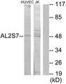 CDK15 / ALS2CR7 Antibody - Western blot analysis of extracts from HuvEc cells and Jurkat cells, using AL2S7 antibody.
