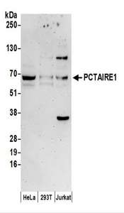 CDK16 / PCTAIRE Antibody - Detection of Human PCTAIRE1 by Western Blot. Samples: Whole cell lysate (50 ug) prepared using NETN buffer from HeLa, 293T, and Jurkat cells. Antibodies: Affinity purified rabbit anti-PCTAIRE1 antibody used for WB at 0.1 ug/ml. Detection: Chemiluminescence with an exposure time of 3 minutes.