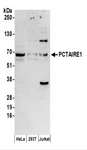 CDK16 / PCTAIRE Antibody - Detection of Human PCTAIRE1 by Western Blot. Samples: Whole cell lysate (50 ug) prepared using NETN buffer from HeLa, 293T, and Jurkat cells. Antibodies: Affinity purified rabbit anti-PCTAIRE1 antibody used for WB at 0.1 ug/ml. Detection: Chemiluminescence with an exposure time of 3 minutes.