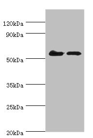 CDK16 / PCTAIRE Antibody - Western blot All lanes: CDK16 antibody at 5µg/ml Lane 1: Mouse brain tissue Lane 2: Mouse small intestineSecondary Goat polyclonal to rabbit IgG at 1/10000 dilution Predicted band size: 56, 64, 57 kDa Observed band size: 56 kDa