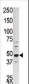 CDK16 / PCTAIRE Antibody - Western blot of PCTK1 Antibody in HepG2 tissue lysate. PCTK1 (arrow) was detected using the purified antibody;