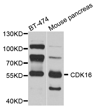 CDK16 / PCTAIRE Antibody - Western blot blot of extract of various cells, using CDK16 antibody.