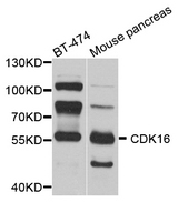 CDK16 / PCTAIRE Antibody - Western blot blot of extract of various cells, using CDK16 antibody.