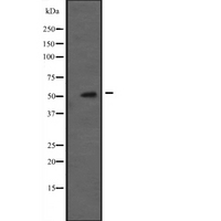 CDK16 / PCTAIRE Antibody - Western blot analysis of PCTK1 expression in A431 whole cells lysate. The lane on the left is treated with the antigen-specific peptide.