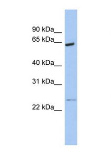 CDK16 / PCTAIRE Antibody - CDK16 / PCTK1 antibody Western blot of Small Intestine lysate. Antibody concentration 1 ug/ml. This image was taken for the unconjugated form of this product. Other forms have not been tested.