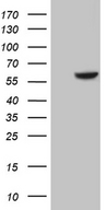 CDK17 / PCTK2 / PCTAIRE2 Antibody - HEK293T cells were transfected with the pCMV6-ENTRY control. (Left lane) or pCMV6-ENTRY CDK17. (Right lane) cDNA for 48 hrs and lysed