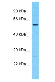 CDK17 / PCTK2 / PCTAIRE2 Antibody - CDK17 / PCTK2 / PCTAIRE2 antibody Western Blot of 293T. Antibody dilution: 1 ug/ml.  This image was taken for the unconjugated form of this product. Other forms have not been tested.
