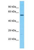 CDK17 / PCTK2 / PCTAIRE2 Antibody - CDK17 / PCTK2 / PCTAIRE2 antibody Western Blot of 293T. Antibody dilution: 1 ug/ml.  This image was taken for the unconjugated form of this product. Other forms have not been tested.