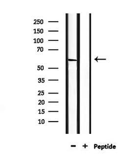 CDK17 / PCTK2 / PCTAIRE2 Antibody - Western blot analysis of extracts of mouse heart tissue using PCTK2 antibody.