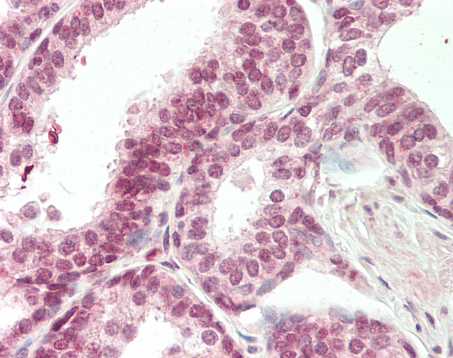 CDK19 / CDK11 Antibody - Human Prostate: Formalin-Fixed, Paraffin-Embedded (FFPE).  This image was taken for the unconjugated form of this product. Other forms have not been tested.