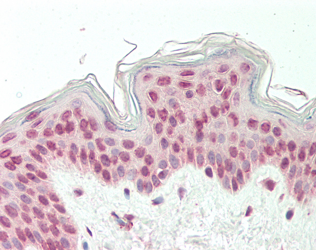 CDK19 / CDK11 Antibody - Human Skin: Formalin-Fixed, Paraffin-Embedded (FFPE).  This image was taken for the unconjugated form of this product. Other forms have not been tested.