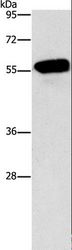 CDK19 / CDK11 Antibody - Western blot analysis of Mouse eyes tissue, using CDK19 Polyclonal Antibody at dilution of 1:950.