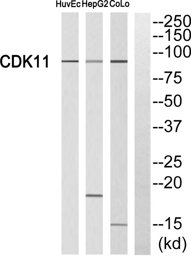 CDK19 / CDK11 Antibody - Western blot of extracts from HUVEC cells, HepG2 cells and CoLo cells, using CDK11 antibody.