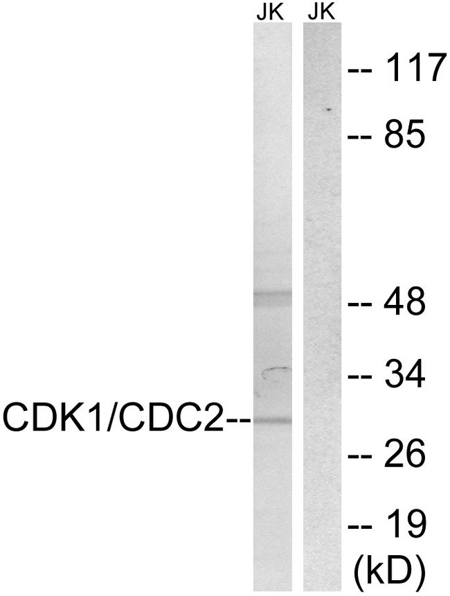 CDK2 Antibody - Western blot analysis of lysates from HepG2 cells, treated with Forskolin 40nM 30', using CDK1/CDC2 Antibody. The lane on the right is blocked with the synthesized peptide.