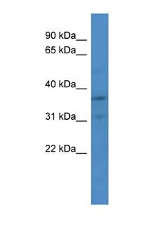 CDK2 Antibody - CDK2 antibody Western blot of Jurkat Cell lysate. Antibody concentration 1 ug/ml.  This image was taken for the unconjugated form of this product. Other forms have not been tested.