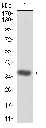CDK2 Antibody - Western blot using CDK2 monoclonal antibody against human CDK2 (AA: 197-295) recombinant protein. (Expected MW is 36.8 kDa)