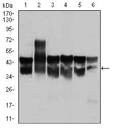 CDK2 Antibody - Western blot using CDK2 mouse monoclonal antibody against Jurkat (1), HL-60 (2), K562(3), A431(4), HeLa(5), and NIH3T3 (6) cell lysate.