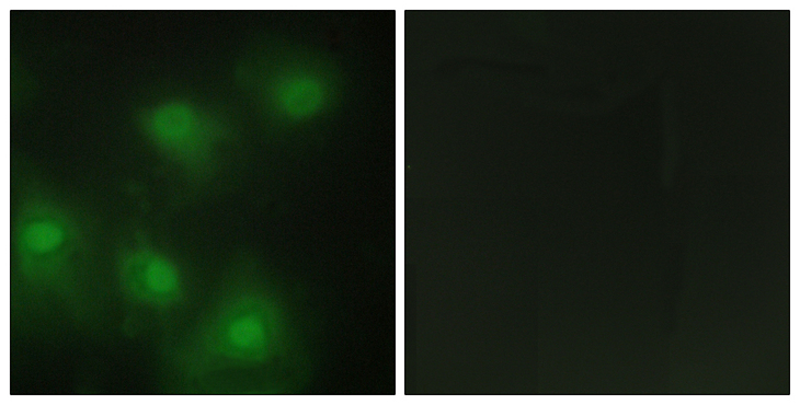 CDK2 Antibody - Immunofluorescence analysis of HeLa cells, using CDK2 Antibody. The picture on the right is blocked with the synthesized peptide.