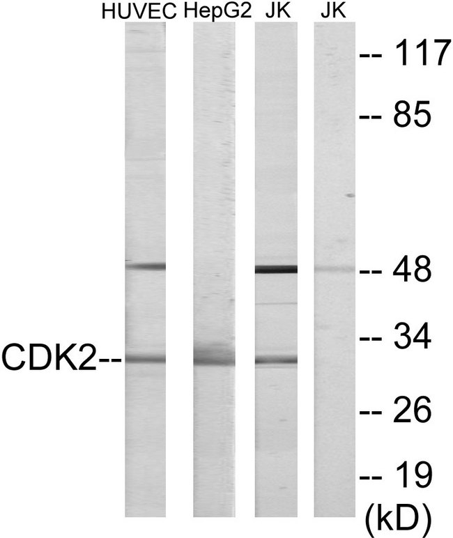 CDK2 Antibody - Western blot analysis of lysates from HUVEC, HepG2, and Jurkat cells, using CDK2 Antibody. The lane on the right is blocked with the synthesized peptide.